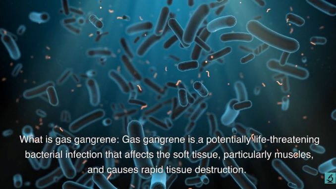 W_1117 A긴급기도